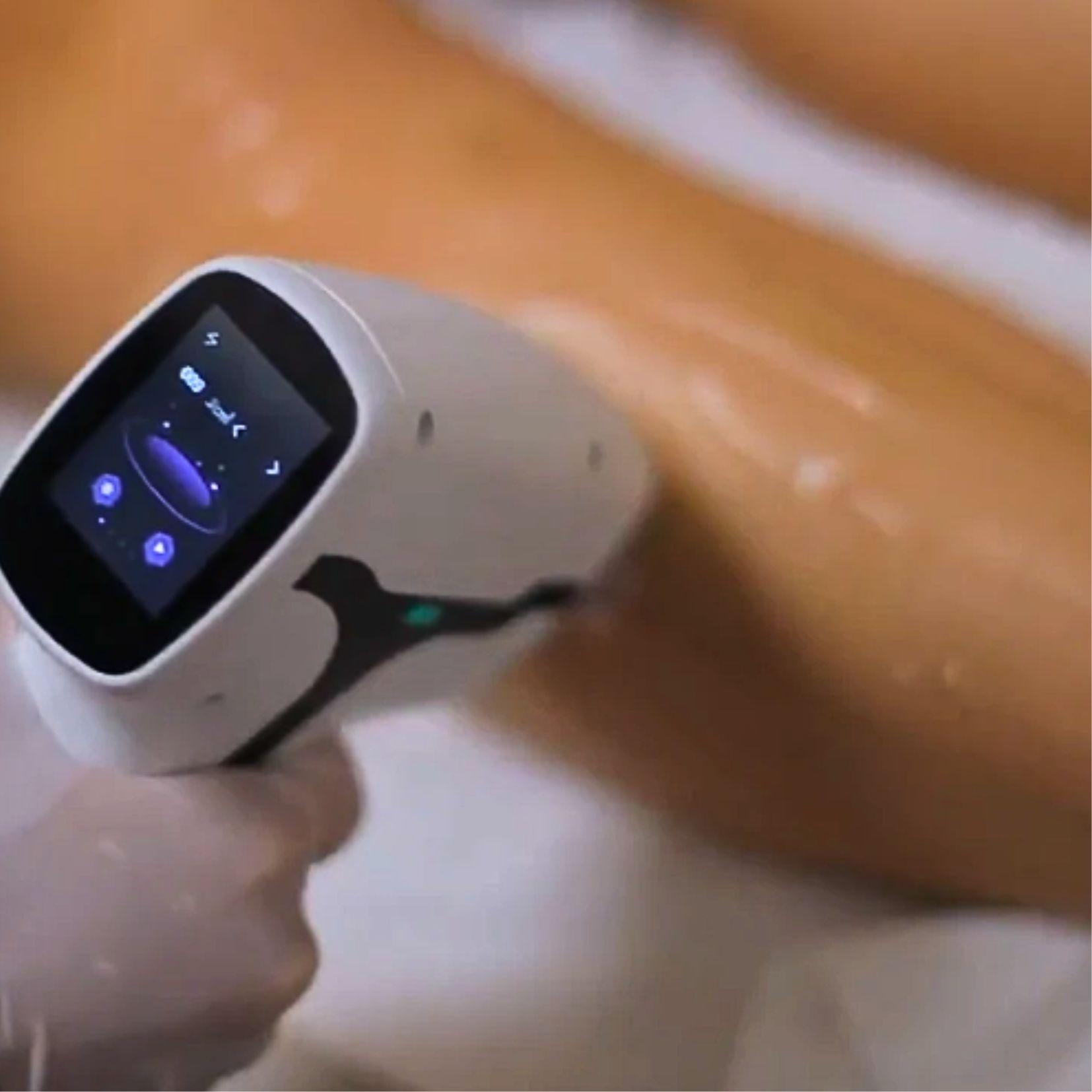 1-Bilan préalable Laser Diode image